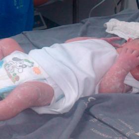 Neonato 