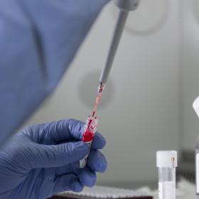 Médico analizando muestra de sangre de cordón umbilical